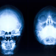 Israeli doctors reconstructed the face of a Syrian casualty. (Shutterstock)