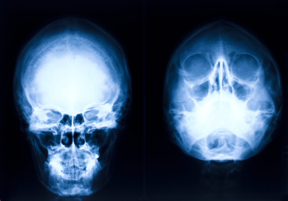 Israeli doctors reconstructed the face of a Syrian casualty. (Shutterstock)