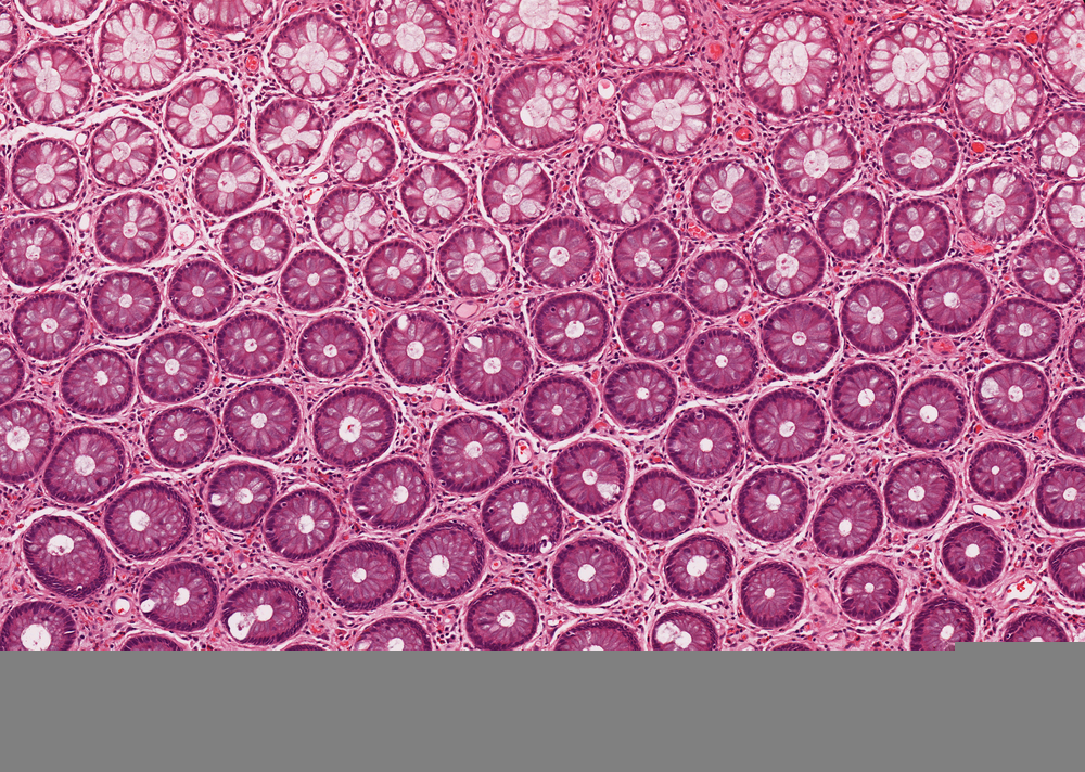 Tissue cells