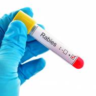Israel anti-rabies vaccine