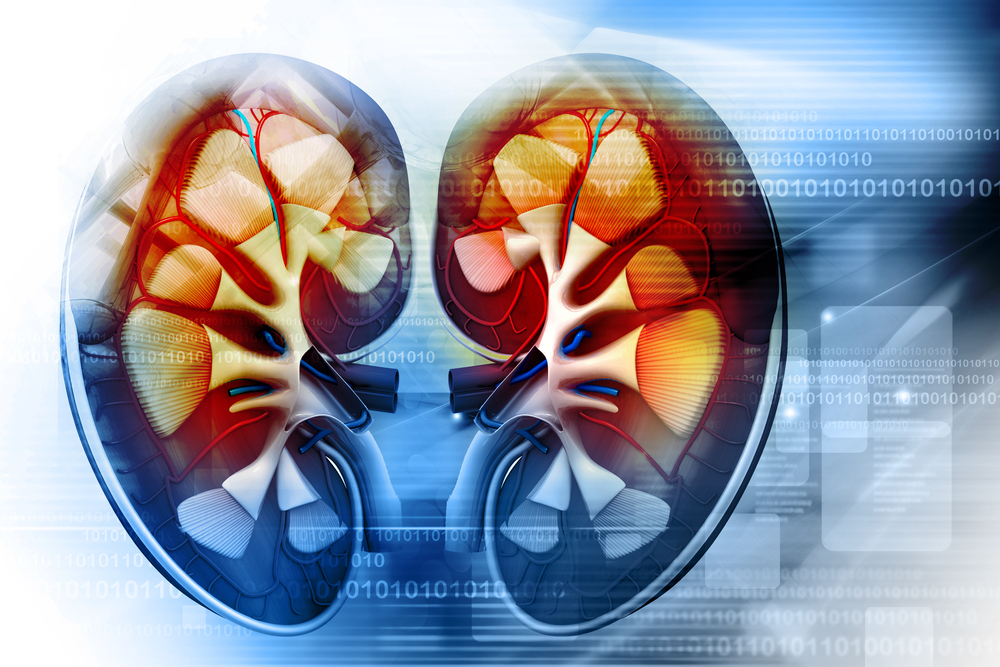 kidney cancer