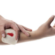 blood clot