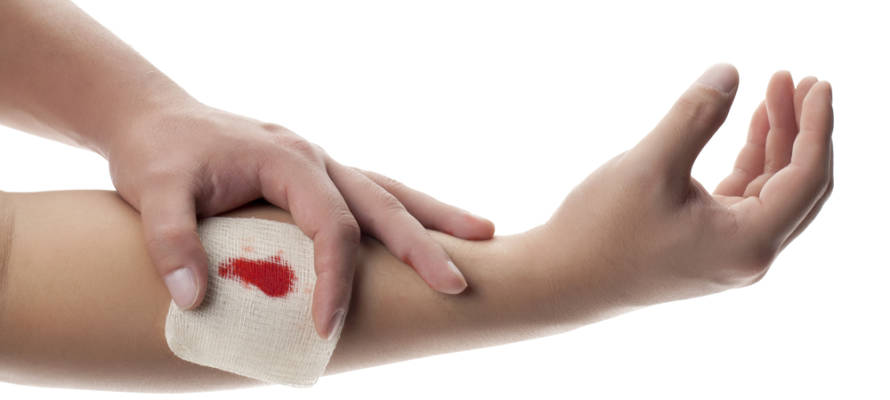 blood clot