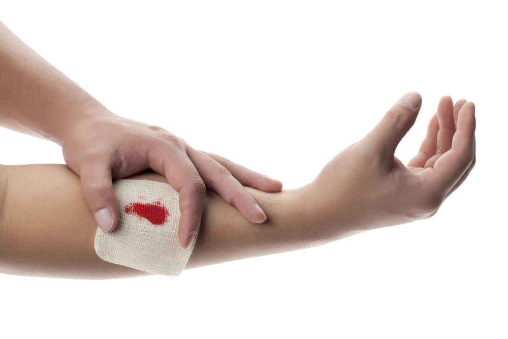 blood clot