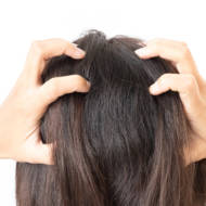 Head lice