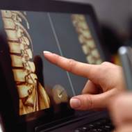 spine medicine