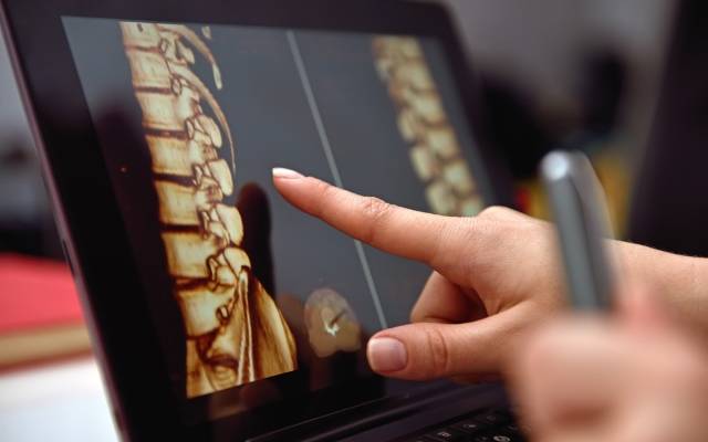 spine medicine