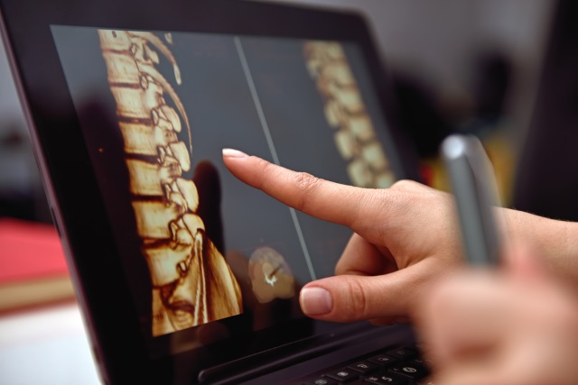 spine medicine