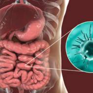 parasitic disease
