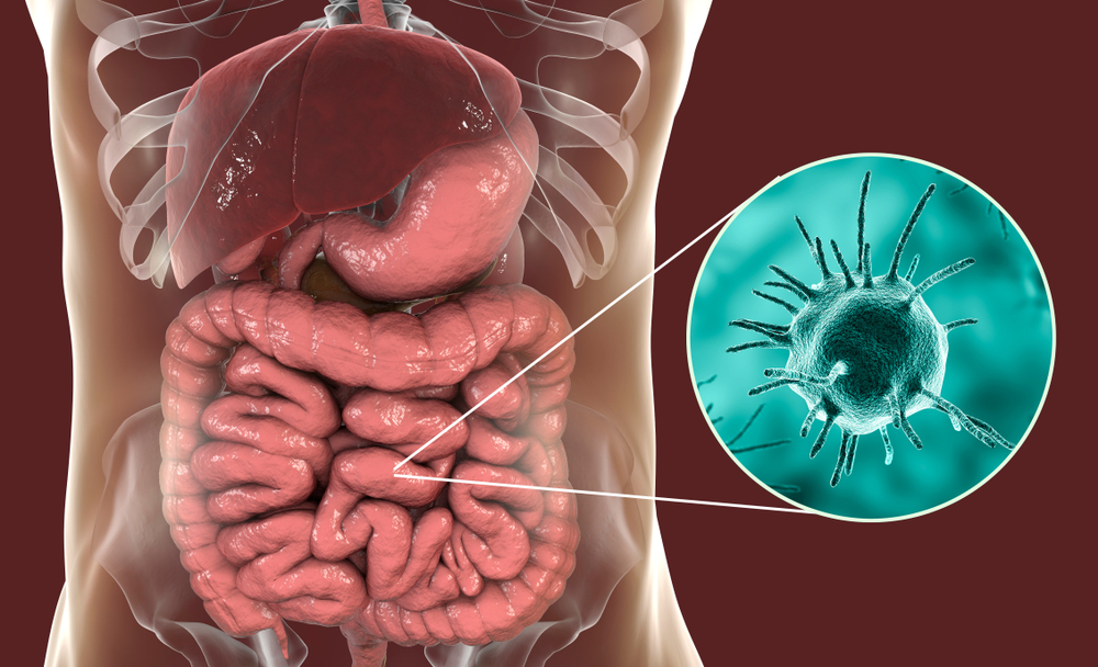 parasitic disease