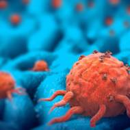 cancer cells
