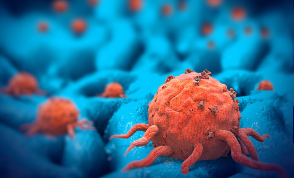 cancer cells