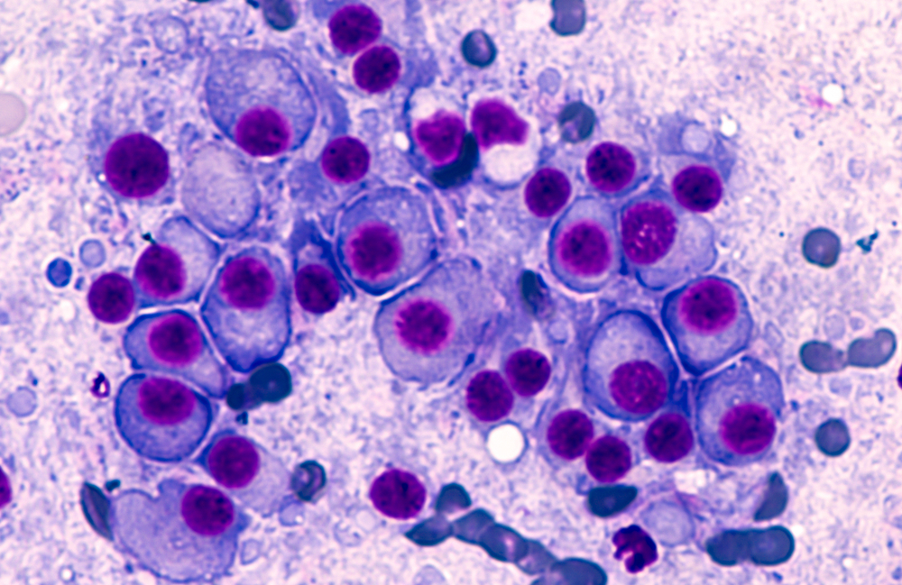blood cancer cells