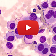 Melanoma Cancer Cells