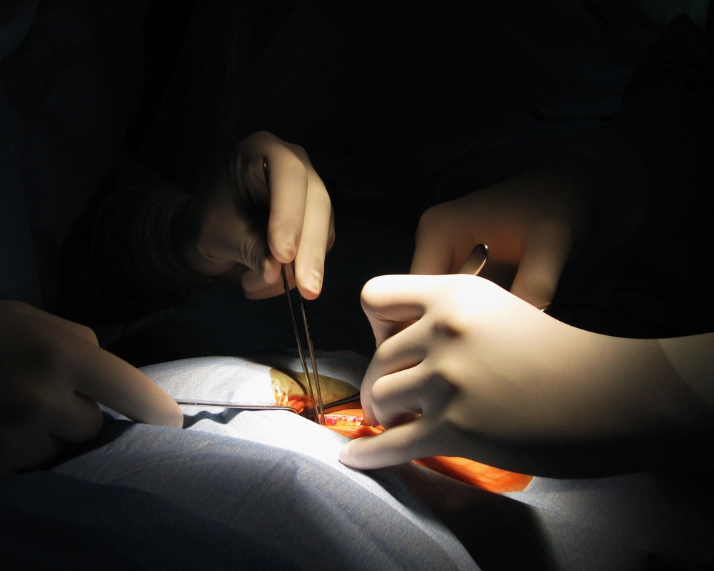 Surgery