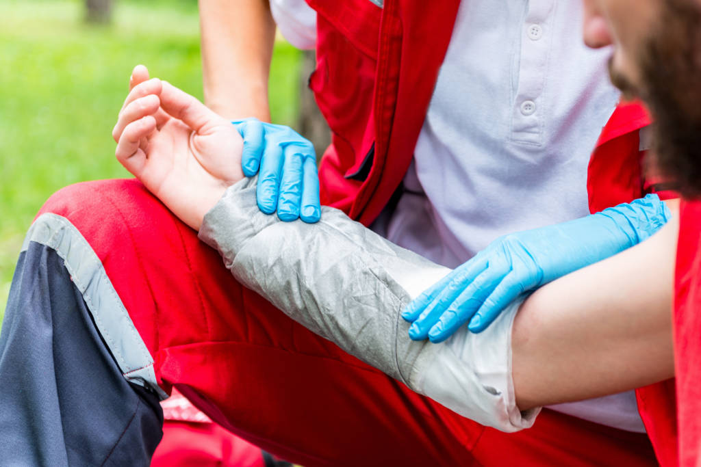 treating burn