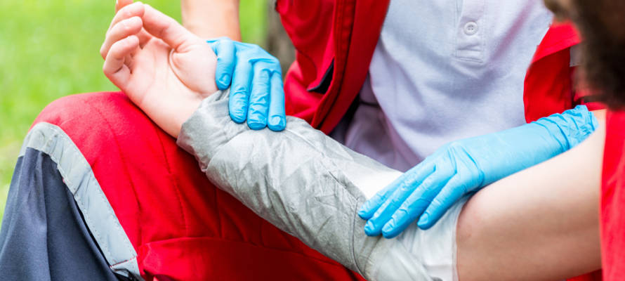 treating burn