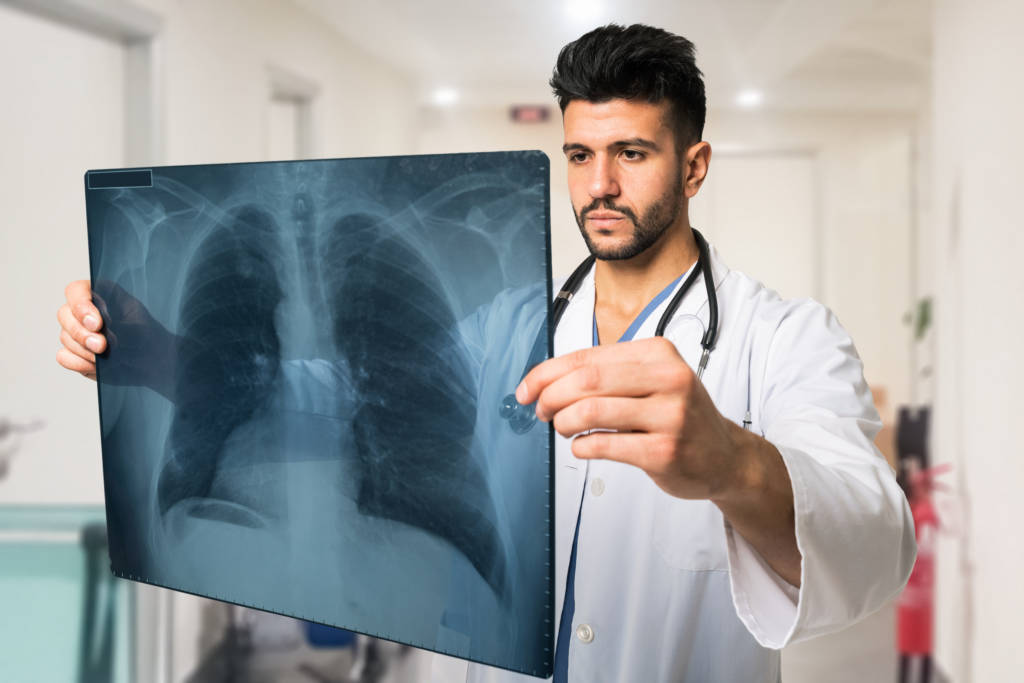 Doctor examining a lung radiography