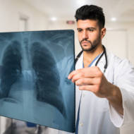 Doctor examining a lung radiography