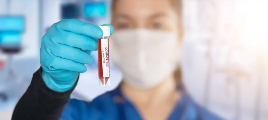 Coronavirus research