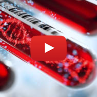 Molecule of DNA in Blood Test