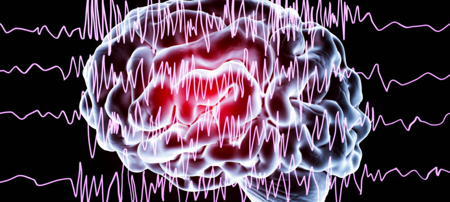 epilepsy seizure
