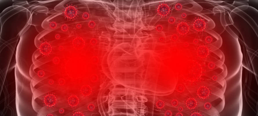 damage in lungs of Covid-19 patient