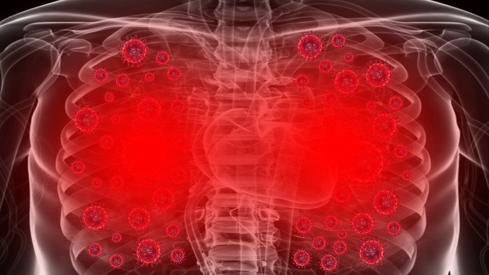 damage in lungs of Covid-19 patient