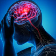 headache brain stroke