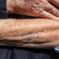 Holocaust survivor tattoo