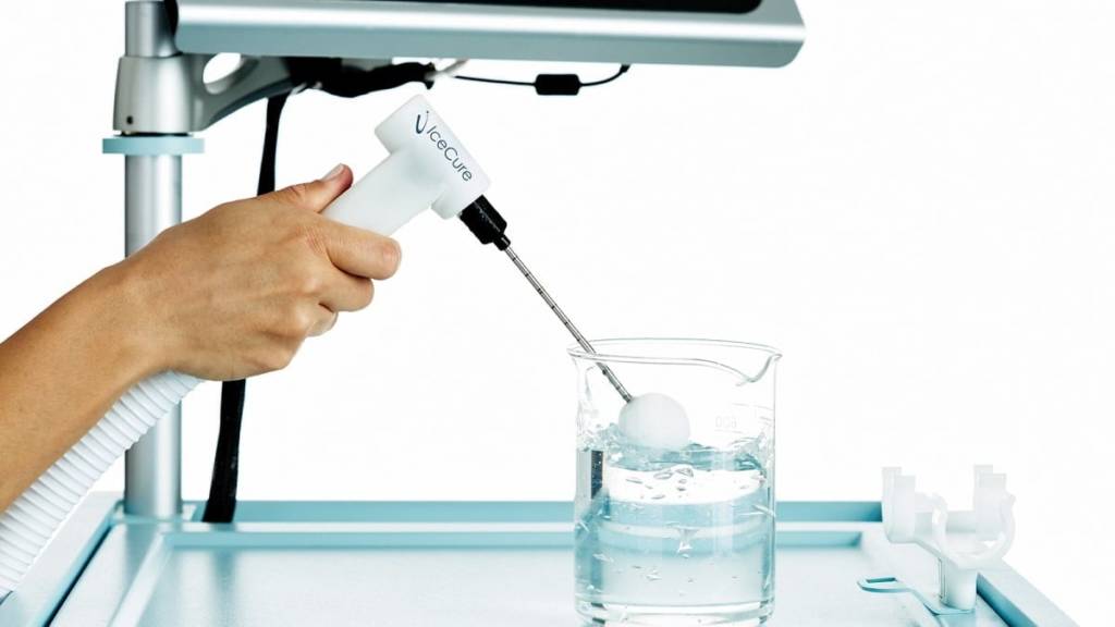 IceCure cancer treatment