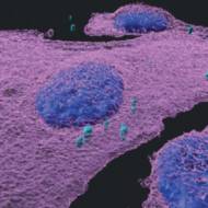 melanoma cells