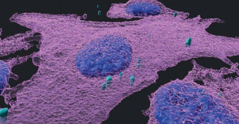 melanoma cells