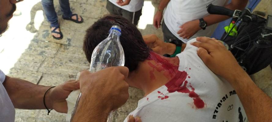 Jerusalem violence