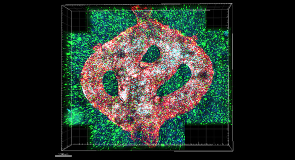 bioprinted tumor