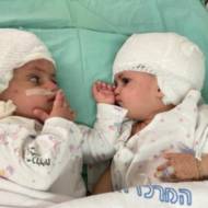 twins