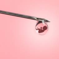 IVF