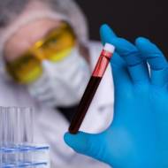 blood test
