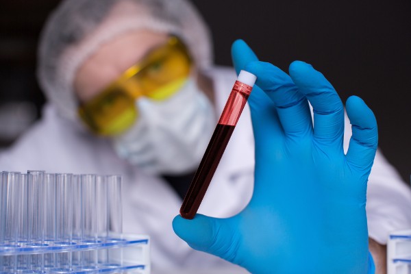 blood test