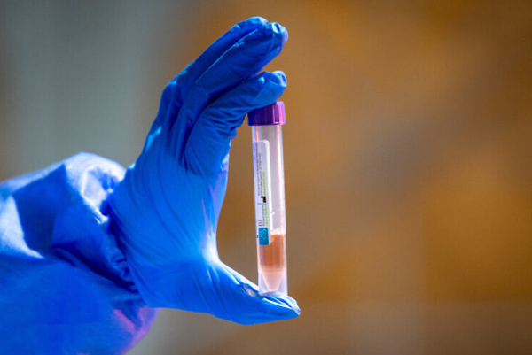 CORONAVIRUS
