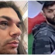Antisemitic Attack NY