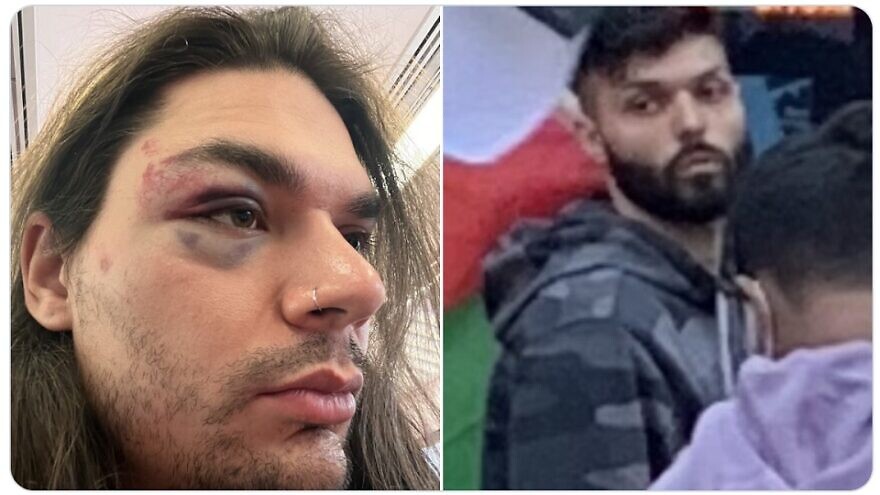 Antisemitic Attack NY