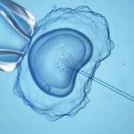 IVF