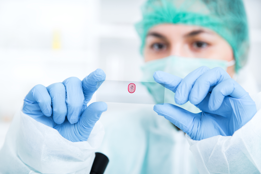 checking medical test
