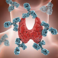 autoimmune disease