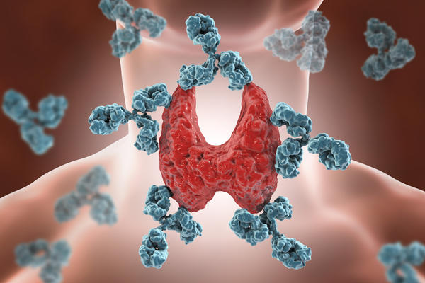 autoimmune disease