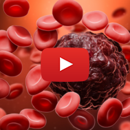 Blood Cancer