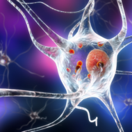 Parkinson's disease