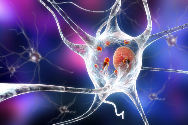Parkinson's disease