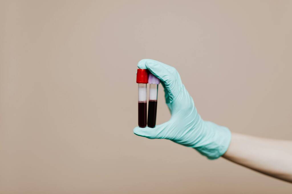 blood test